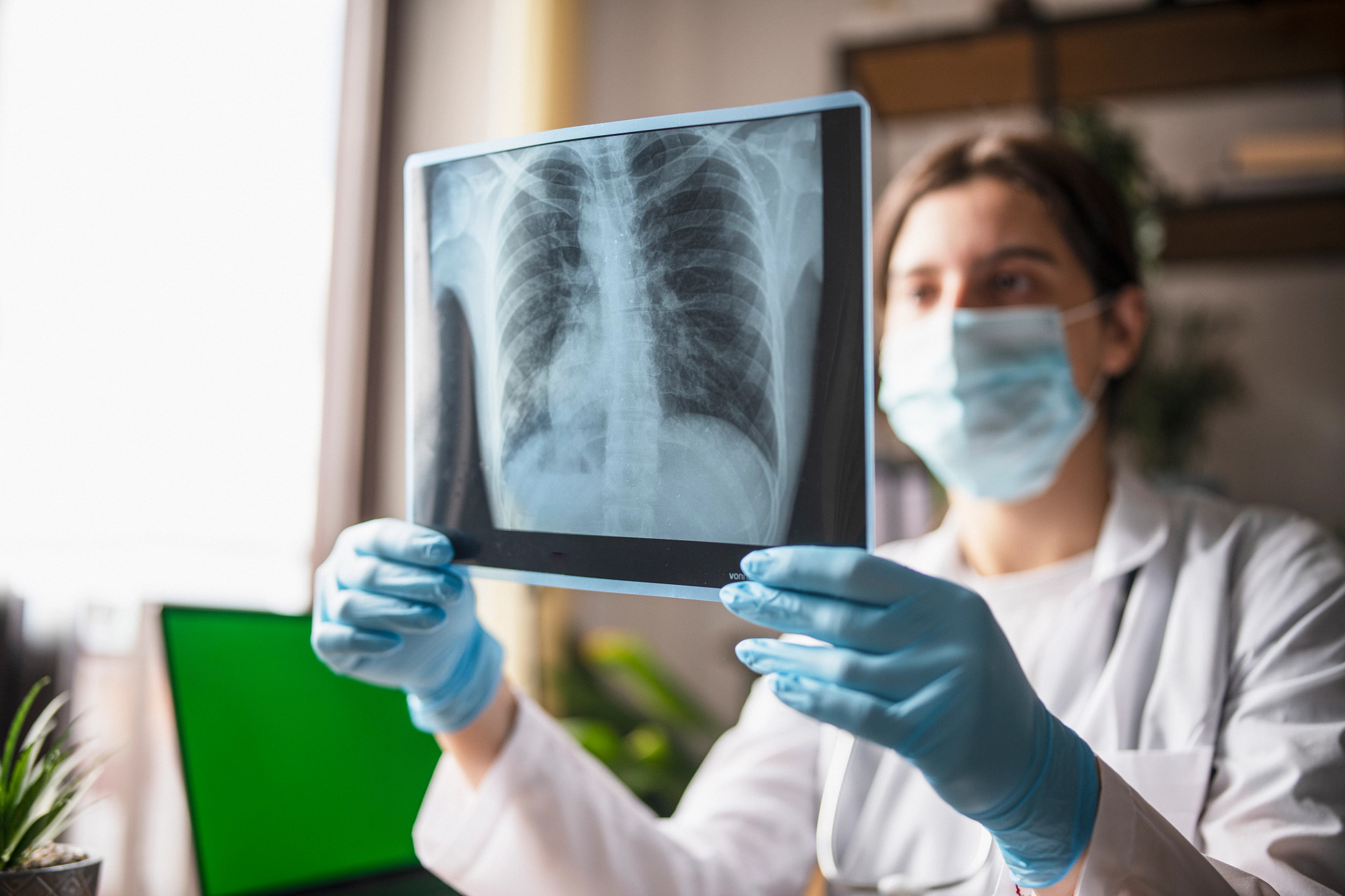 Female Doctor Looking At X-Ray