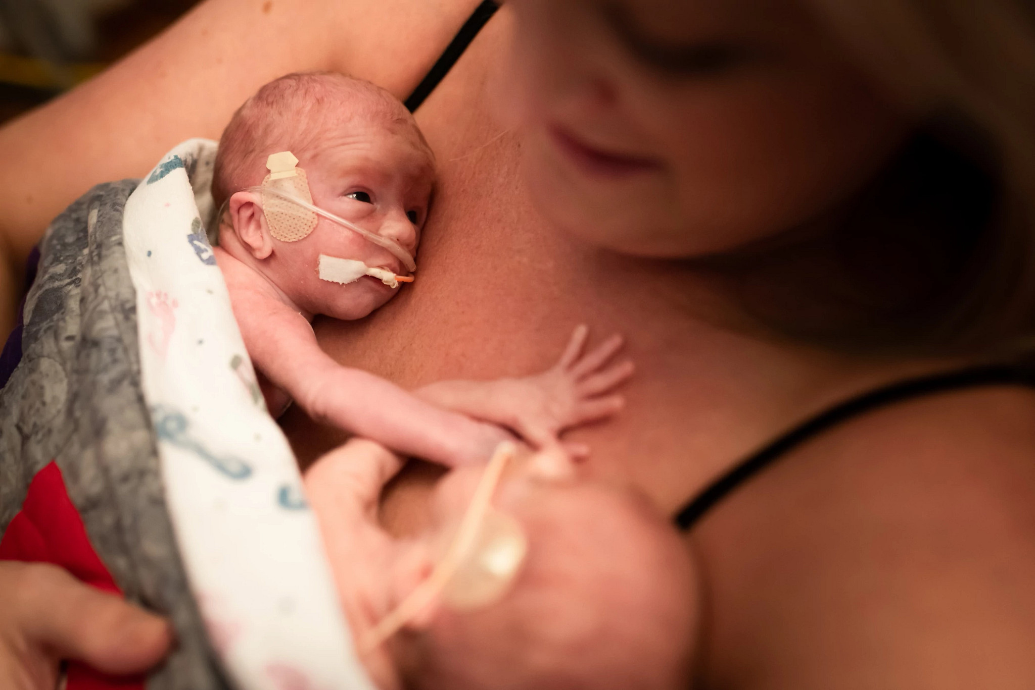 Premature twins held skin to skin by mother in hospital NICU.